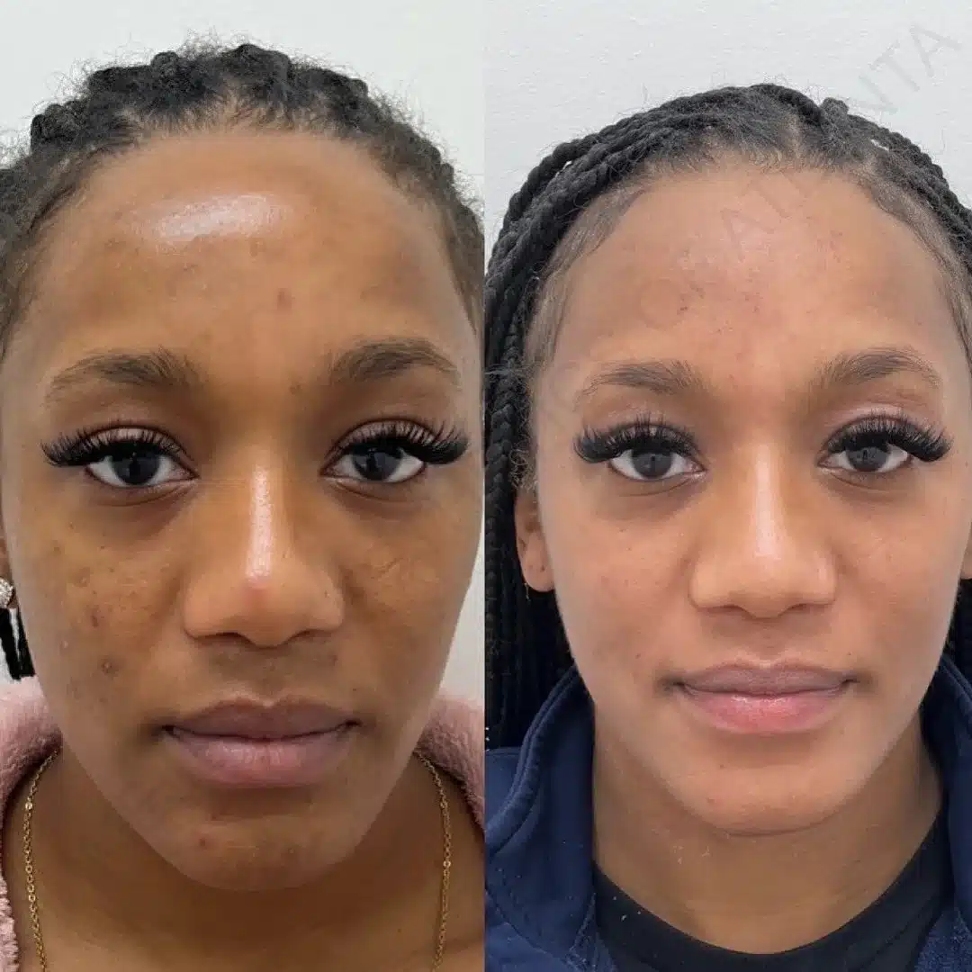 Before and After Image: Aesthetics - front