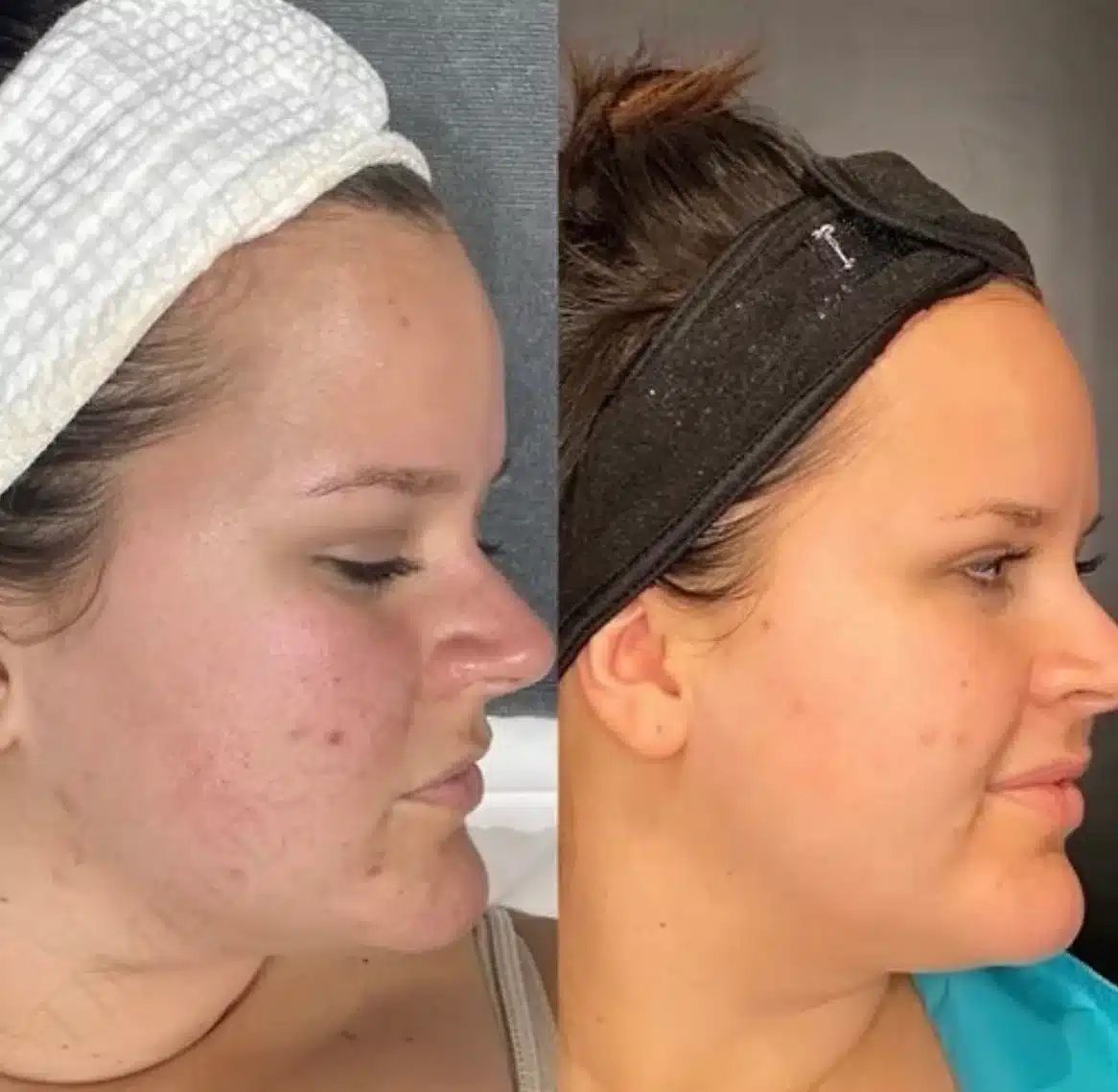 Before and After Image: Aesthetics - right-front-oblique