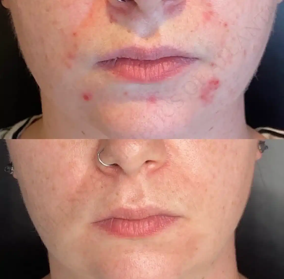 Before and After Image: Aesthetics - front