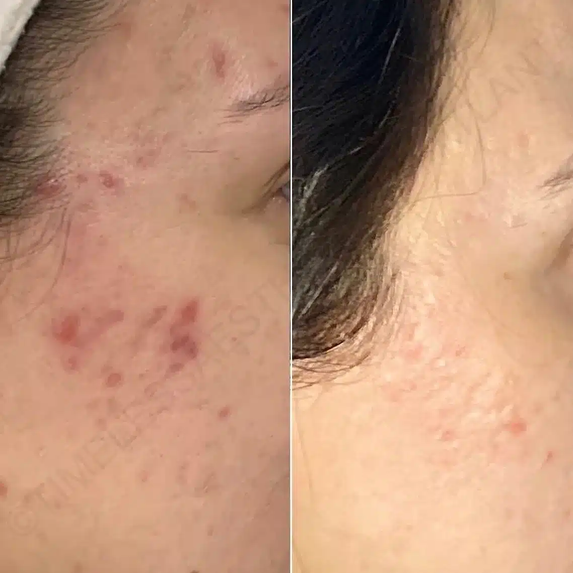 Before and After Image: Aesthetics - right-side