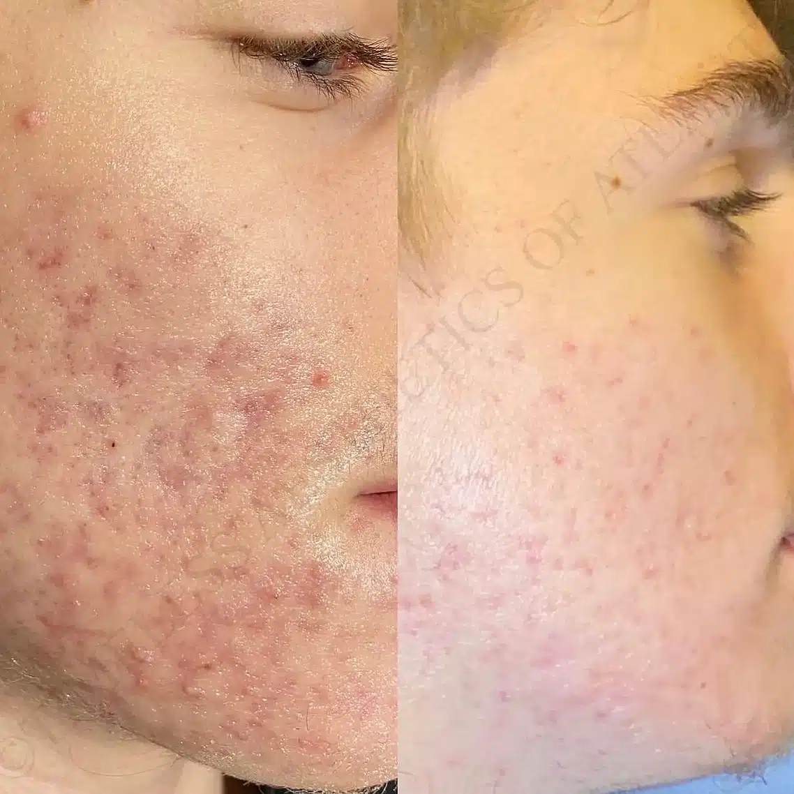 Before and After Image: Aesthetics - right-side